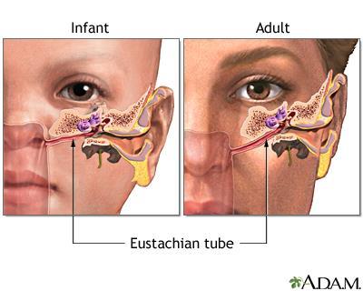 Ear infections in children: Symptoms, treatment and when to see a doctor