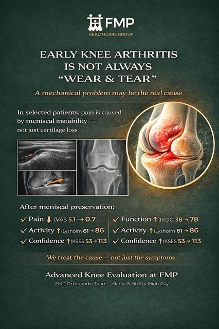 Rethinking early knee osteoarthritis: could the meniscus be the missing link?